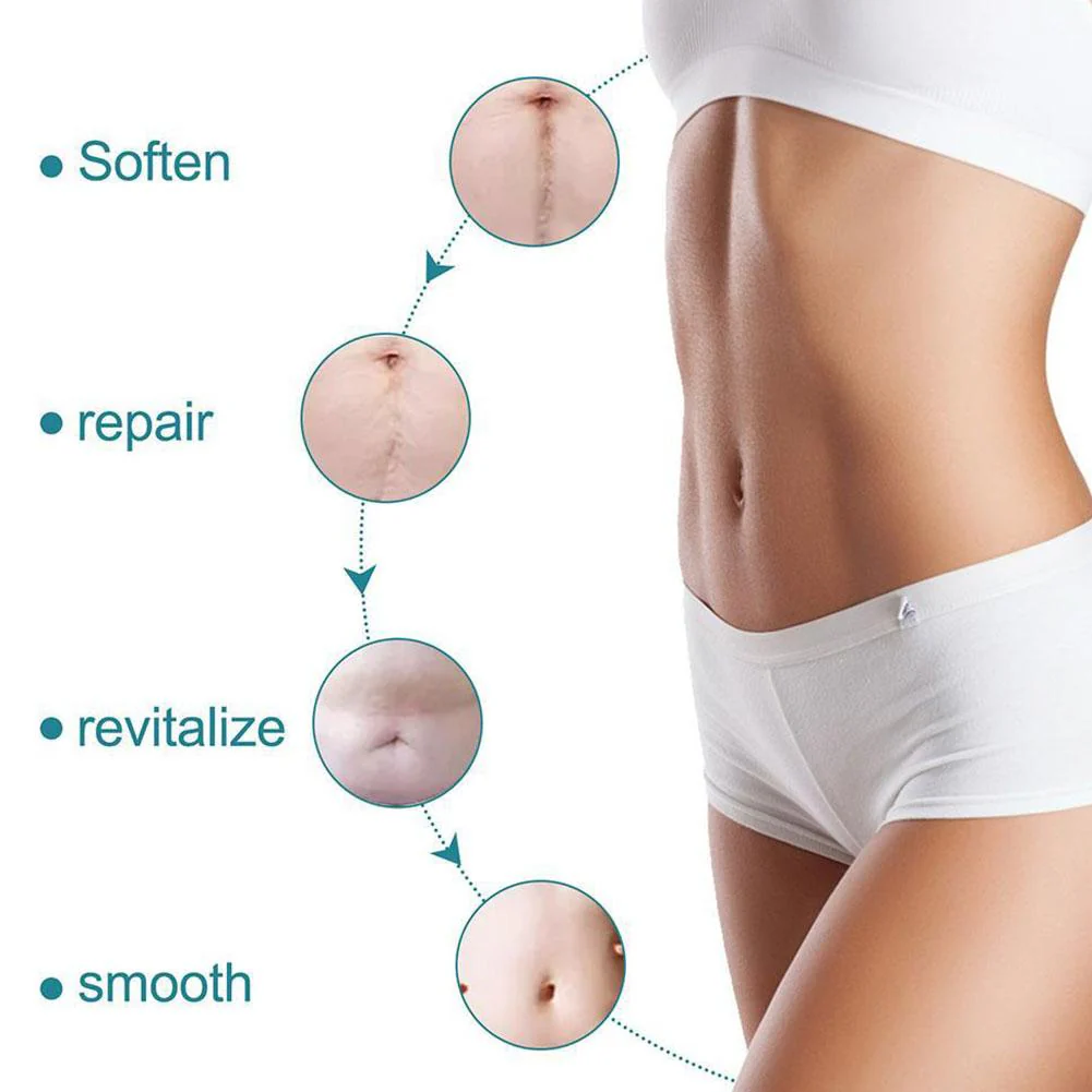 Silicone Scar Sheets for Surgery & Acne Scars (Buy 1 Get 1 Free) - Image 3