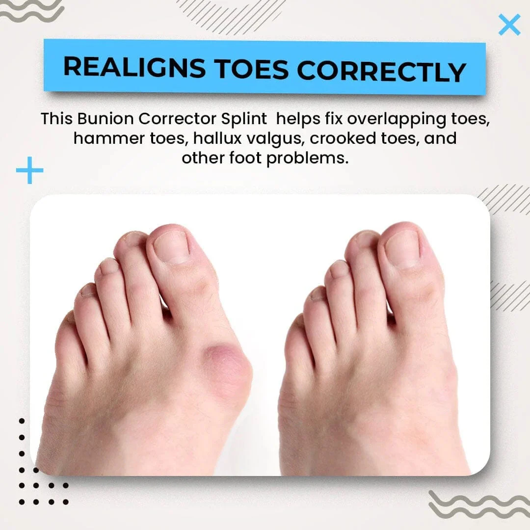 3D Bunion Splint Corrector - Image 3